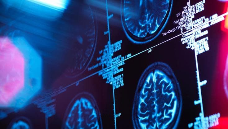 Previsioni, sintomi e nuove cure: le cinque risposte sull’Alzheimer