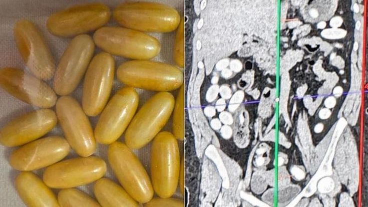 Bolzano supera Milano nel consumo di cocaina e canapa: così le acque reflue rivelano l’uso di droghe
