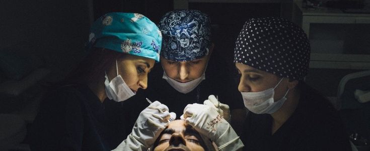  Uomini mai calvi, l’ossessione del trapianto turco 