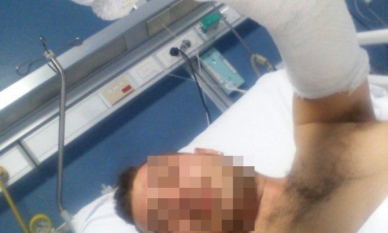 Roma, esplode un contatore del gas durante lavori: feriti due operai e il proprietario di casa
