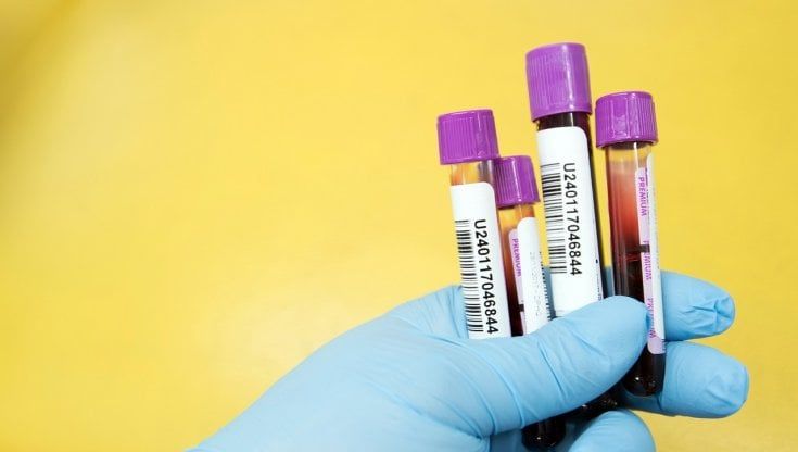 Approvata una nuova terapia per il linfoma non-Hodgkin più comune