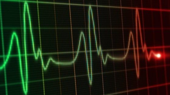 Perché ha forti dolori al petto se l'Ecg è nella norma?