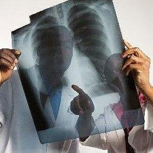 Non vede il tumore e il paziente muore<br />Medico condannato a risarcire 150 mila euro