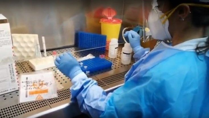 Anticorpi, un nuovo test può svelare quanto possiamo fidarci del nostro sistema immunitario