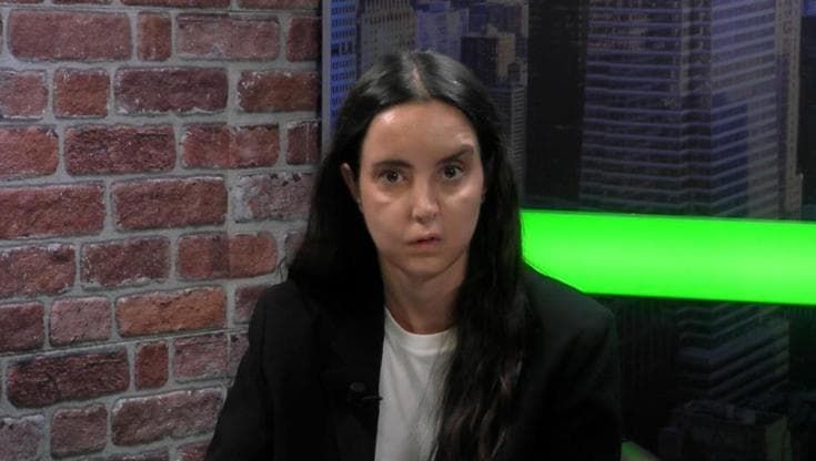 Camilla Mancini: "La paresi al viso? Coi bulli mi sono sentita diversa, oggi so che sono speciale"