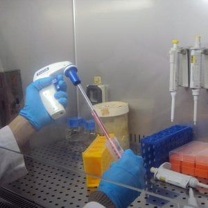 Diabete: trapianto cellule su un uomo di 41 anni