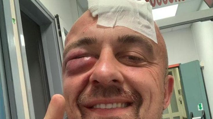Chef Rubio aggredito sotto casa: “Mi hanno massacrato, erano sionisti”