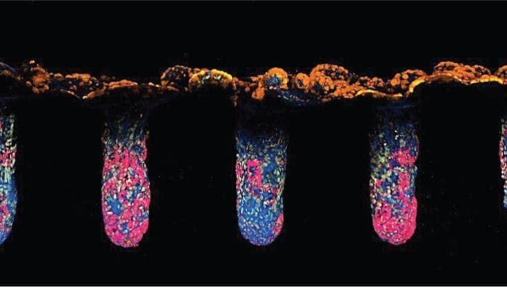 Organoidi e algoritmi: così si studia la biologia delle malattie umane