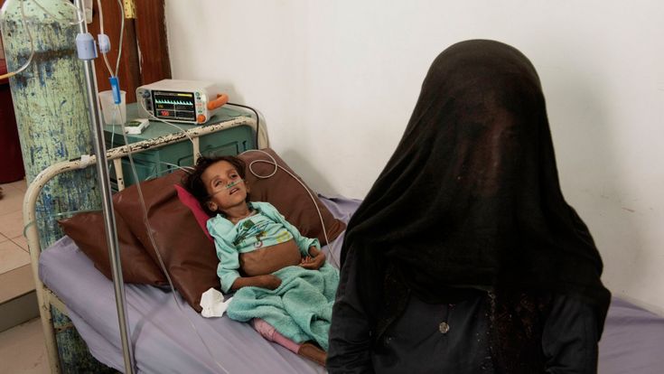 Yemen, i bambini da salvare
