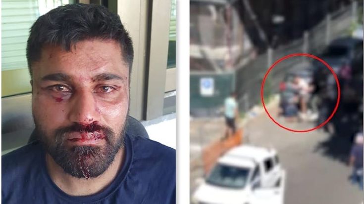 Singh pestato dopo lo scippo: "Denuncio i miei aggressori, chiedo scusa all’anziana". E scappa da Roma