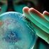 Tumore del rene, il trapianto di microbiota migliora la risposta all’immunoterapia