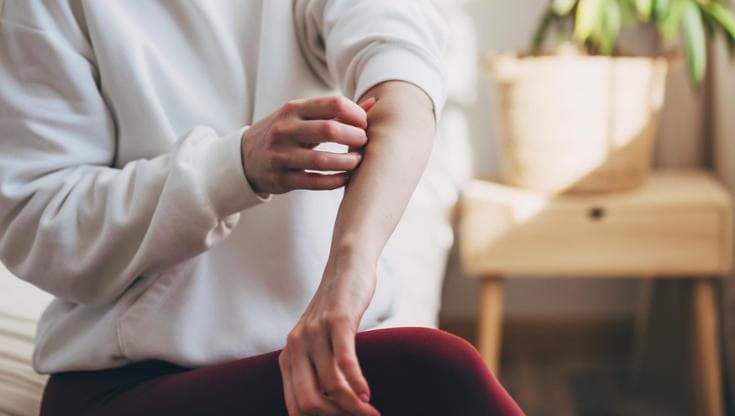 Orticaria e non solo, perché soffriamo per il prurito e come affrontarlo