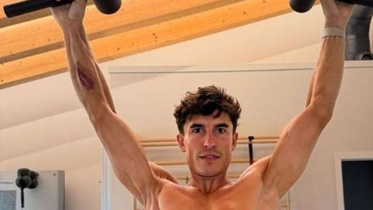 Marc Marquez e l’impressionante foto del braccio operato sette volte che ha rischiato di perdere