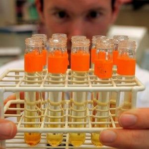 Fibrosi cistica, ricercatori italiani scoprono terapia con timosina