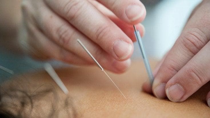 Tumore al seno: chemio, radio e agopuntura. La Toscana porta le terapie complementari nel percorso di cura