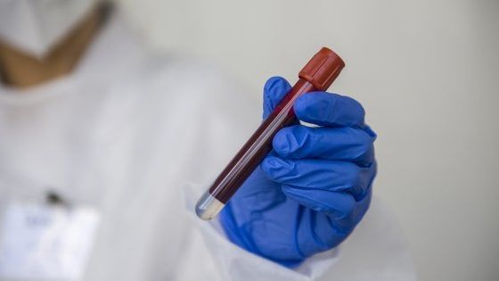 Coronavirus in Emilia-Romagna, altri 4 morti