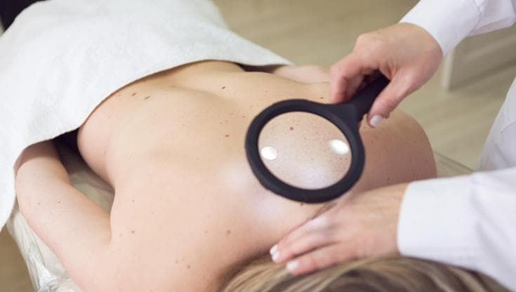 Melanoma: parte la campagna di prevenzione nelle sedi di Unicoop Firenze