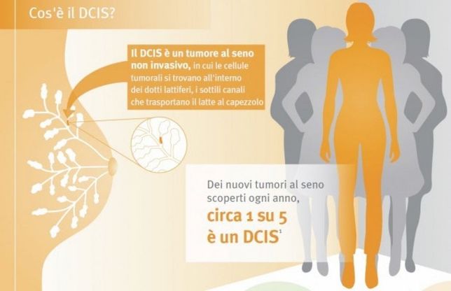 Tumore al seno non invasivo, l'importanza di personalizzare la cura