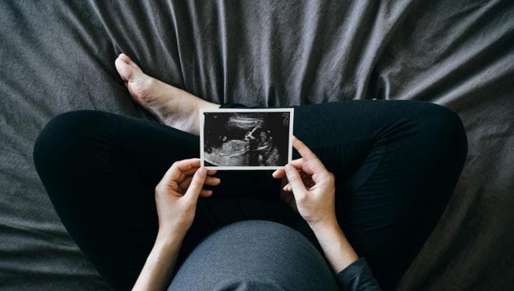 Fertilità, meno chance di avere figli se da piccole si è state sovrappeso o obese