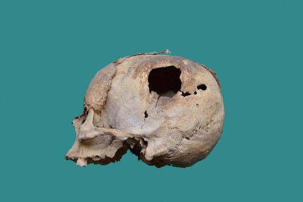 Il cranio del Settecento torna a Comiso
