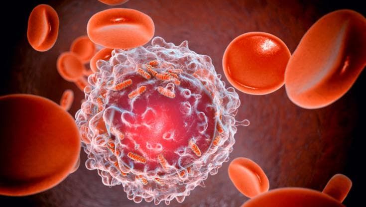 Leucemia mieloide acuta: l’italiana che sfida le recidive
