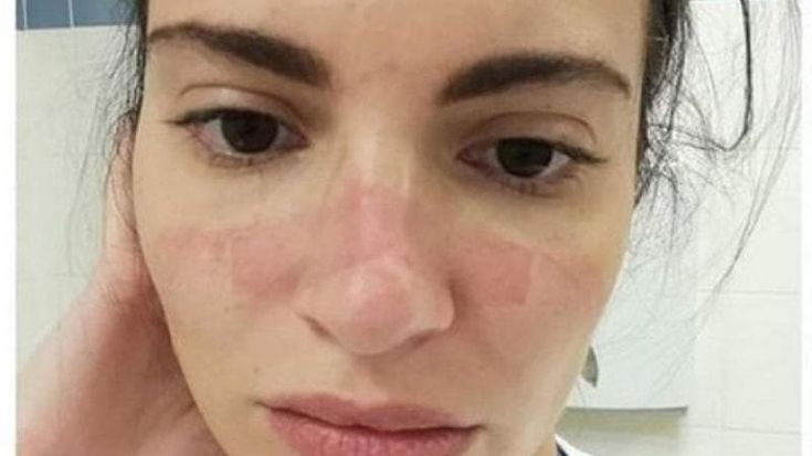 L’infermiera della foto simbolo del Covid: “Il reintegro dei no vax una ferita alla memoria”