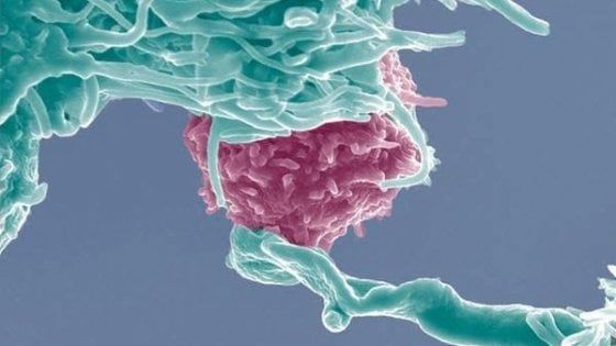 Scoperto l'interruttore del cancro: potrebbe fermare la proliferazione tumorale