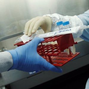 Trieste, pediatra con la Tbc: scoperto bimbo ammalato 