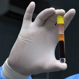 Covid 19: ex zona rossa Sala Consilina, indagine sierologica