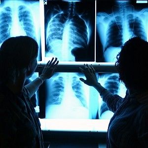 Ospedale, non referta un tumore<br />Corte Conti chiede risarcimento al medico