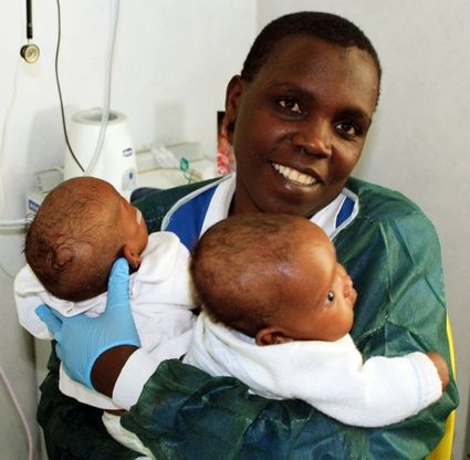 Le due gemelline siamese separate in Italia tornano a casa