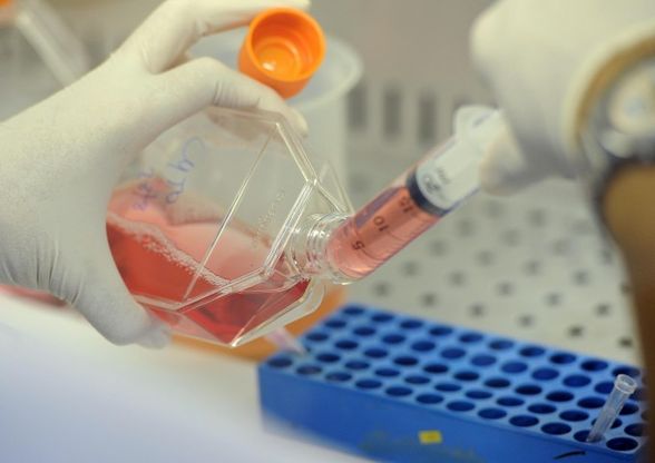 Test del sangue invece dell'amniocentesi? Sembra la volta buona