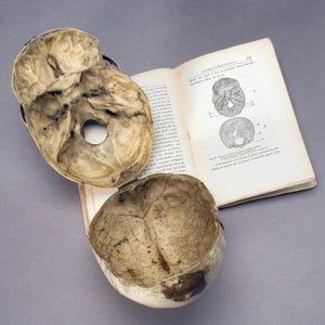 Cassazione, resta al museo Lombroso il cranio conteso del brigante calabrese Villella