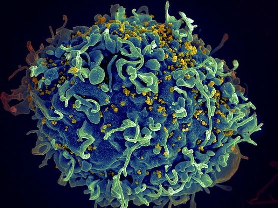 Aids, un vaccino da bere: "Test positivi sulle scimmie"