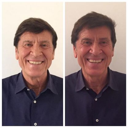 Un anno sul volto di Gianni Morandi: dodici foto segnatempo