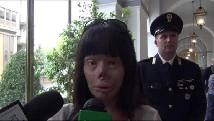 Femminicidio, donna sfigurata: "Il mio caso sia un monito per dire basta"