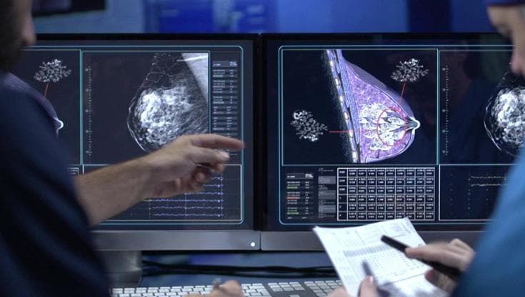 Tumore al seno: con i test genomici fino al 40% delle donne può evitare la chemioterapia