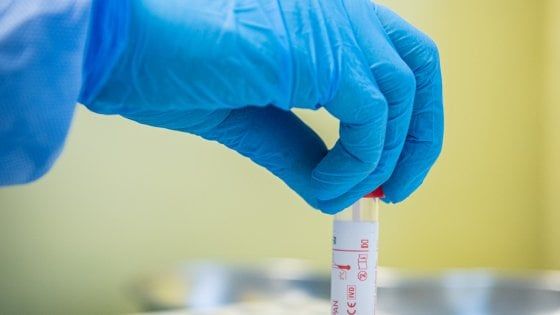 Coronavirus, a Brindisi rubati dall'ospedale i reagenti per tamponi: è il secondo furto in una settimana