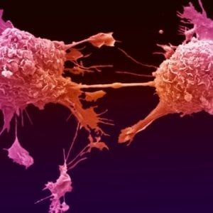 Mutazione RET, un nuovo target per il tumore del polmone