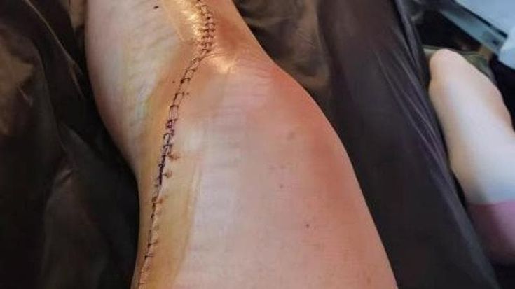 Brignone scherza sull’infortunio: “Ho fatto il record di punti, ma avrei rinunciato agli ultimi 42”