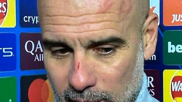 Guardiola con tagli e graffi in viso dopo la rimonta del Feyenoord: “Mi piace farmi del male”