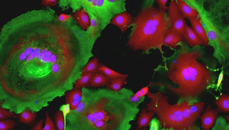 Covid: un farmaco promette di neutralizzare la spike