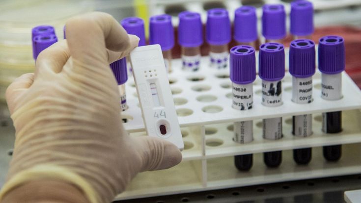 In Umbria scontro sui test sierologici rapidi. L'accusa del Pd a Tesei: "Non attendibili i kit comprati dalla Regione"