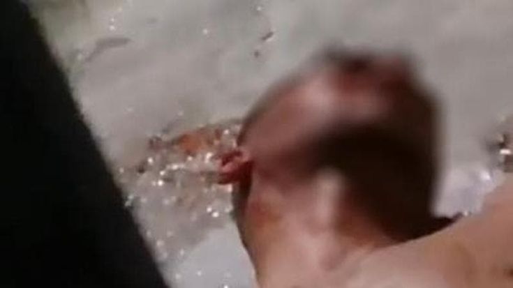 Violenze e pestaggi al Cpr di Gradisca. I medici: “Quei centri sono patogeni, vengano chiusi”
