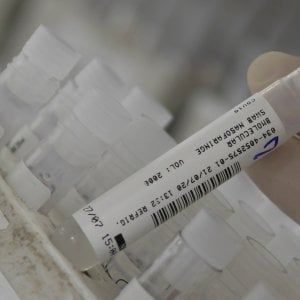 Coronavirus in Emilia-Romagna, 63 casi in 24 ore. Due i decessi