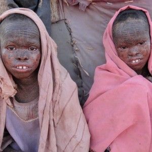Somalia, l'onda lunga della povert&agrave; che provoca malattie e rassegnazione