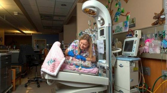 Alla nascita pesava 567 grammi, a 34 anni oggi lavora nel reparto che l'ha salvata