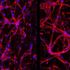 Retina, così le staminali possono riparare i vasi sanguigni