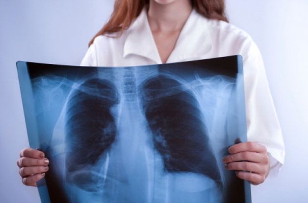 Oms, nel mondo epidemia tumori<br />Nel 2030 i casi saranno 22 milioni