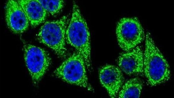Dal made in Italy un farmaco contro il mieloma
